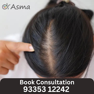 Hair fall Treatment in Lucknow