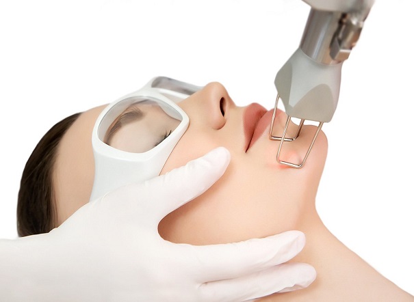 Fractional CO2 Treatment in Lucknow (Acne Scar Removal)