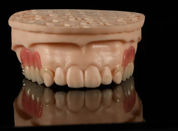 Printed Partial Framework - Co-Cr & Acrylic Partial Denture (Color Clasp)