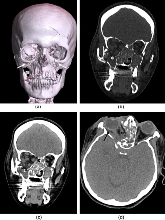 Neuro Medicine & Surgery