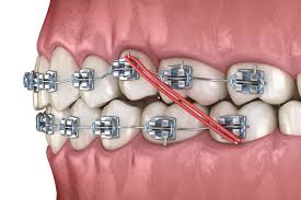 Orthodontics