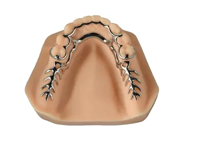 METAL PARTIAL DENTURES