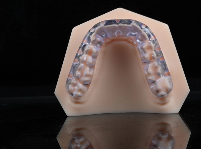 Occlusal Splint (Hard)-3D Print