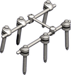 Implantes cirúrgicos