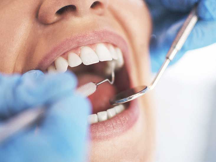 Cosmetic Dentistry