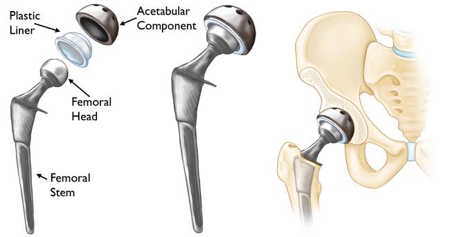 Medische instrumenten