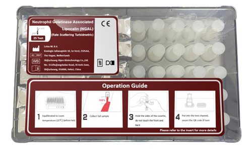 Neutrophil Gelatinase Associated Lipocalin (NGAL) Test